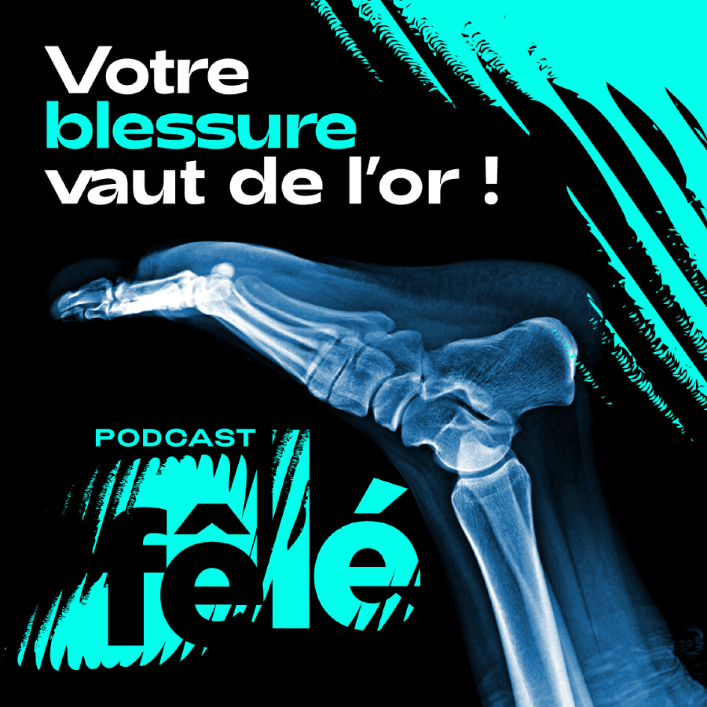 vignette du podcast : Fêlé, votre blessure vaut de l&rsquo;or